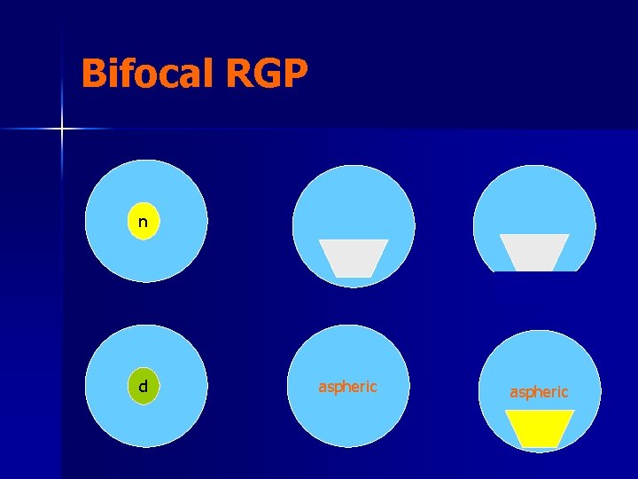 Contact Lenses Overview of basics and considerations for