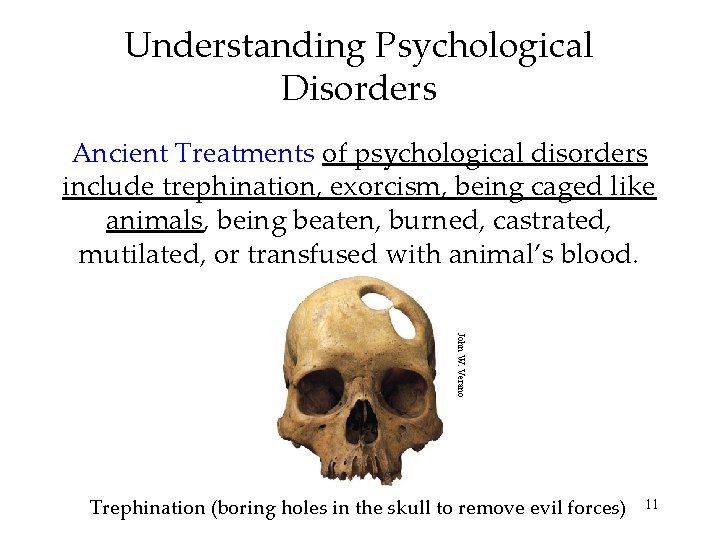 Understanding Psychological Disorders Ancient Treatments of psychological disorders include trephination, exorcism, being caged like