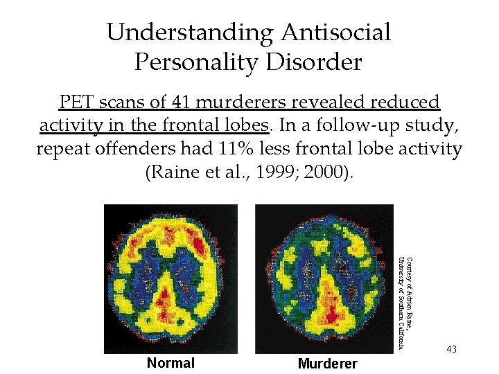 Understanding Antisocial Personality Disorder PET scans of 41 murderers revealed reduced activity in the