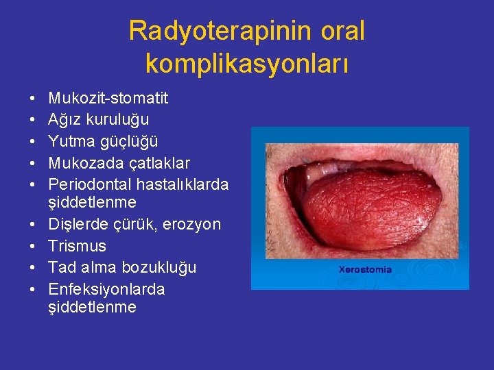 Radyoterapinin oral komplikasyonları • • • Mukozit-stomatit Ağız kuruluğu Yutma güçlüğü Mukozada çatlaklar Periodontal