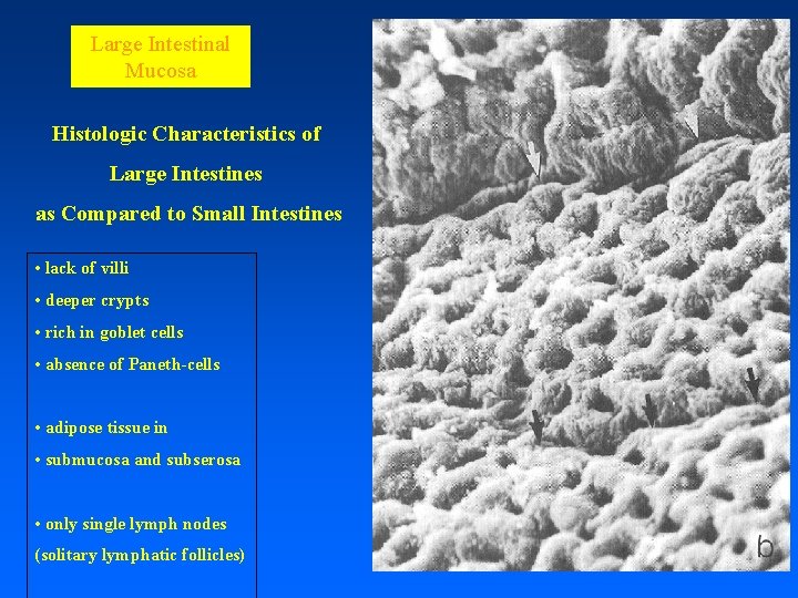 Large Intestinal Mucosa Histologic Characteristics of Large Intestines as Compared to Small Intestines •