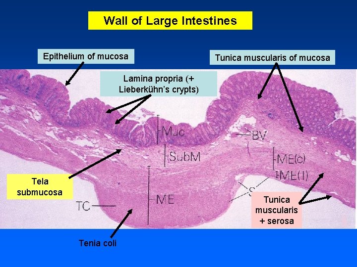 Wall of Large Intestines Epithelium of mucosa Tunica muscularis of mucosa Lamina propria (+