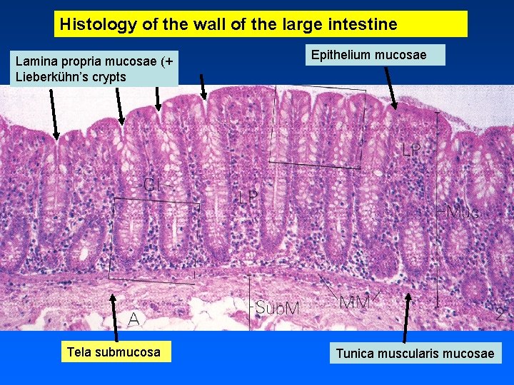 Histology of the wall of the large intestine Lamina propria mucosae (+ Lieberkühn’s crypts