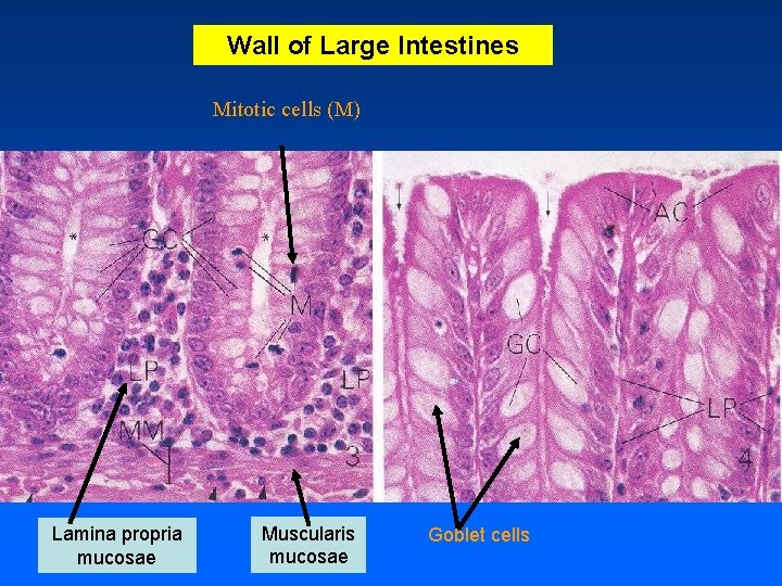 Wall of Large Intestines Mitotic cells (M) Lamina propria mucosae Muscularis mucosae Goblet cells