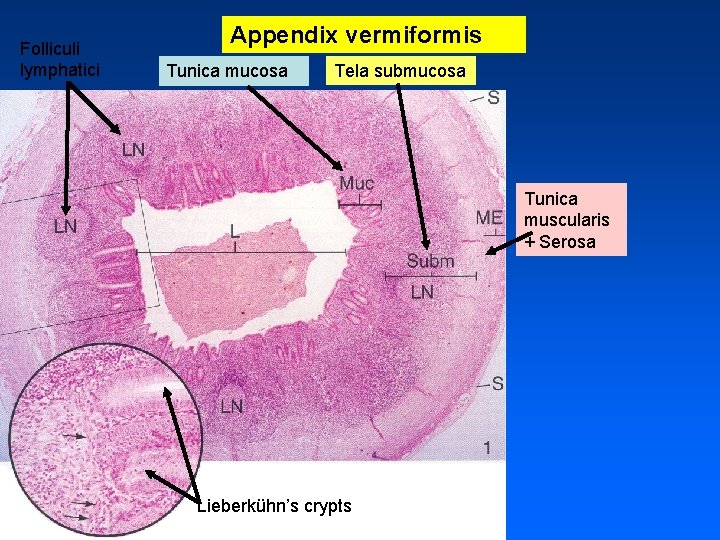 Folliculi lymphatici Appendix vermiformis Tunica mucosa Tela submucosa Tunica muscularis + Serosa Lieberkühn’s crypts