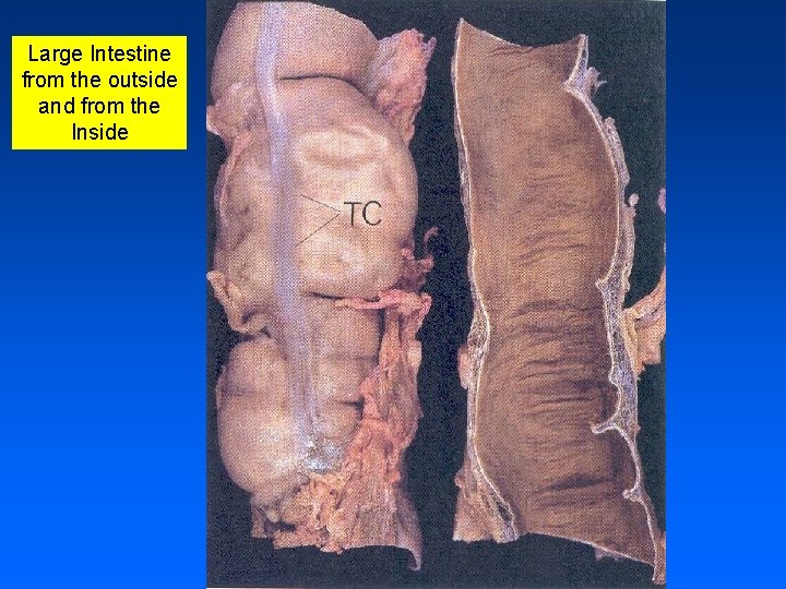 Large Intestine from the outside and from the Inside 