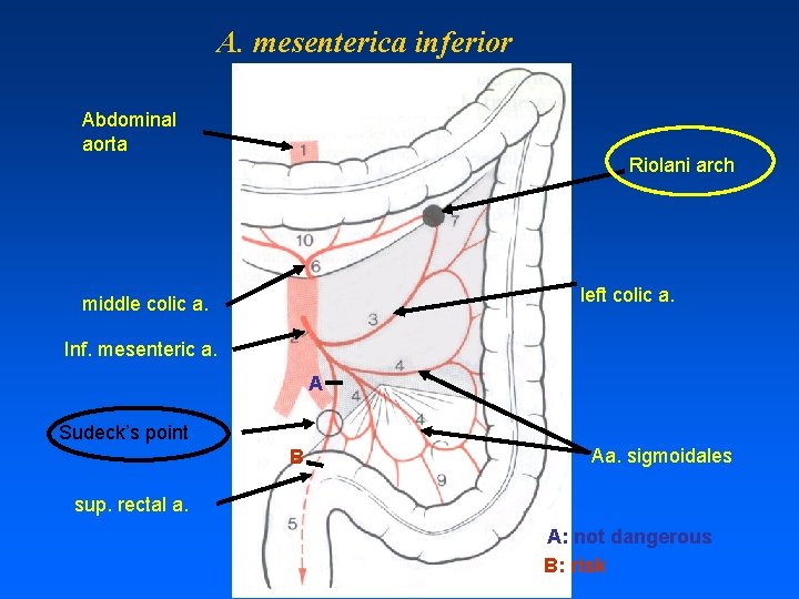 A. mesenterica inferior Abdominal aorta Riolani arch left colic a. middle colic a. Inf.