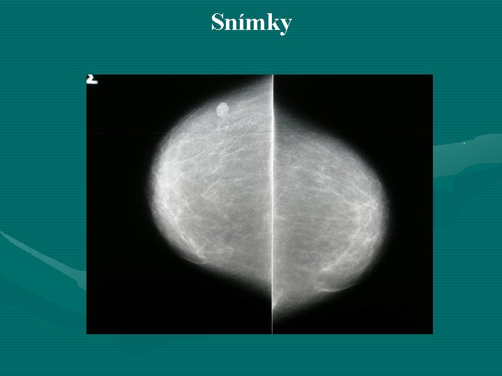 Snímky 