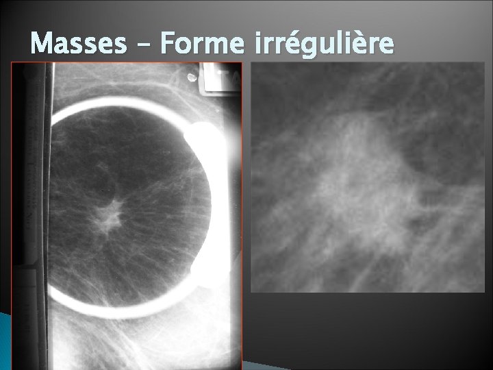 Masses – Forme irrégulière 