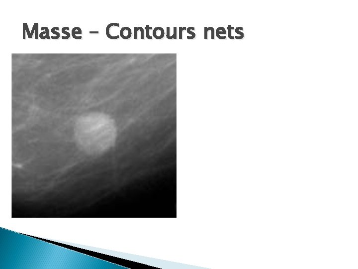 Masse – Contours nets 