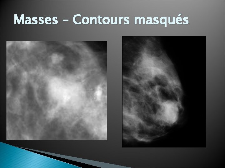 Masses – Contours masqués 