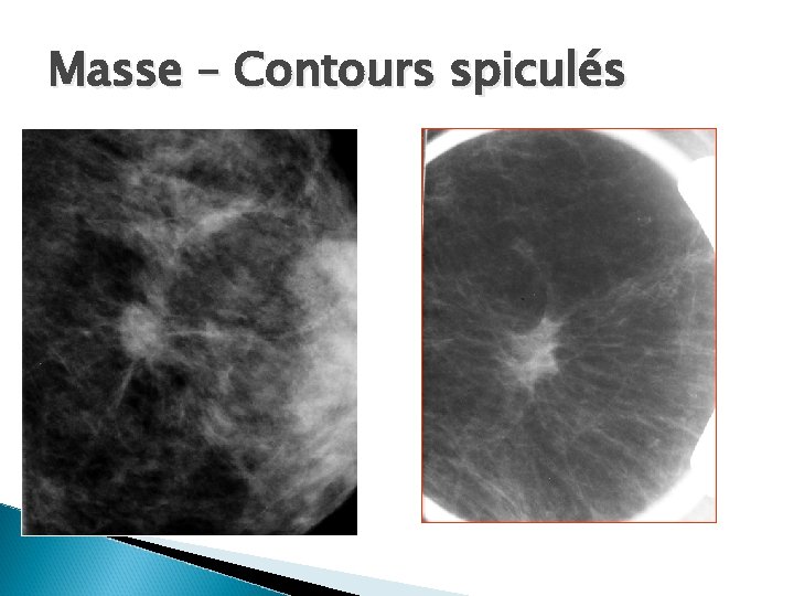 Masse – Contours spiculés 