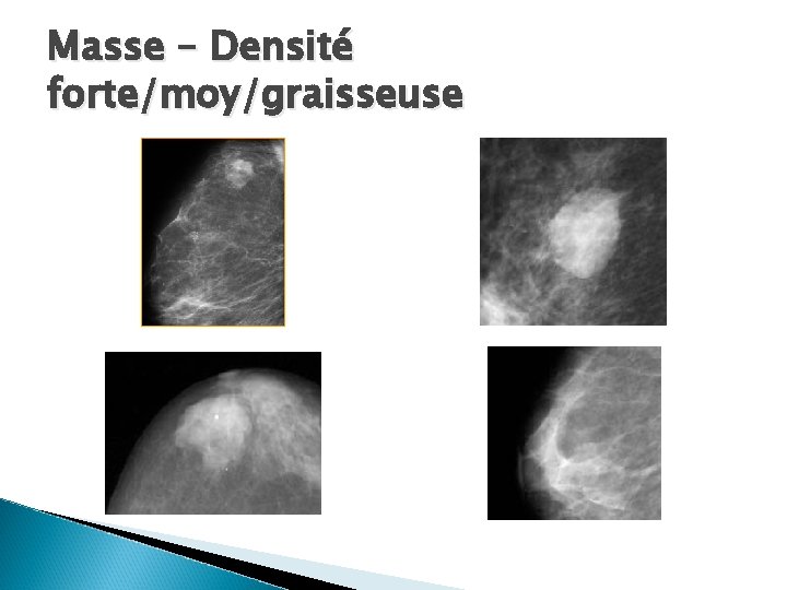 Masse – Densité forte/moy/graisseuse 