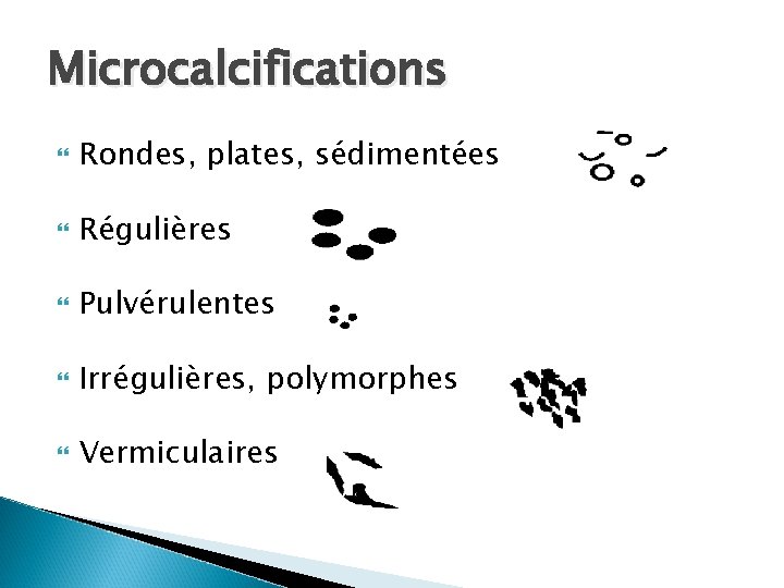 Microcalcifications Rondes, plates, sédimentées Régulières Pulvérulentes Irrégulières, polymorphes Vermiculaires 