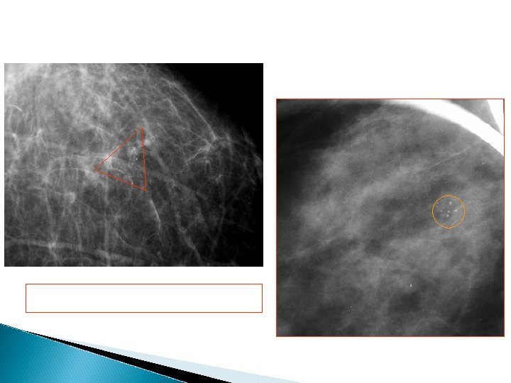 +++Distribution>morphologie 