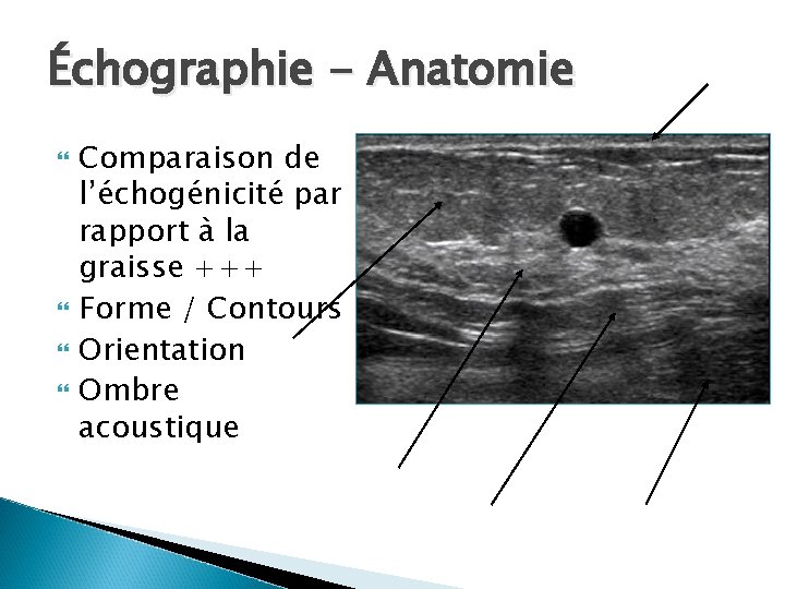 Échographie - Anatomie Comparaison de l’échogénicité par rapport à la graisse +++ Forme /