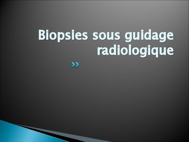 Biopsies sous guidage radiologique 