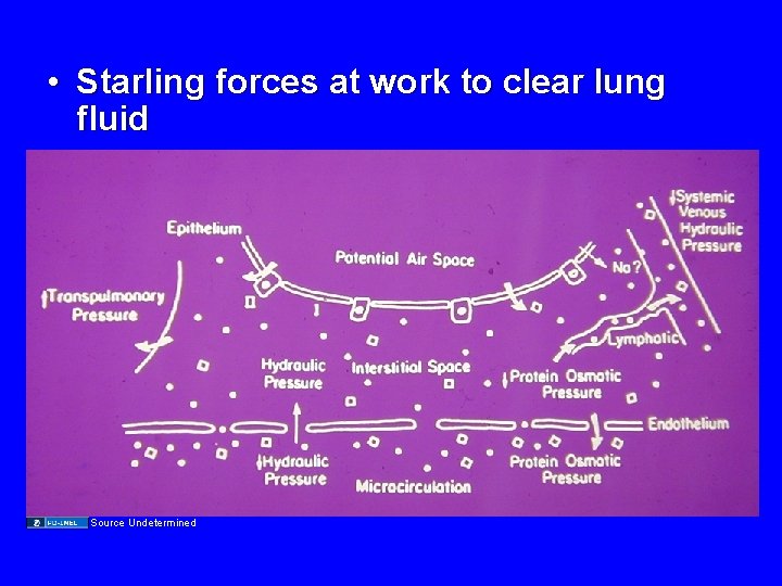  • Starling forces at work to clear lung fluid Source Undetermined 