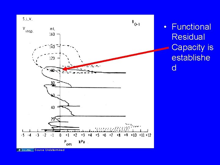  • Functional Residual Capacity is establishe d Source Undetermined 