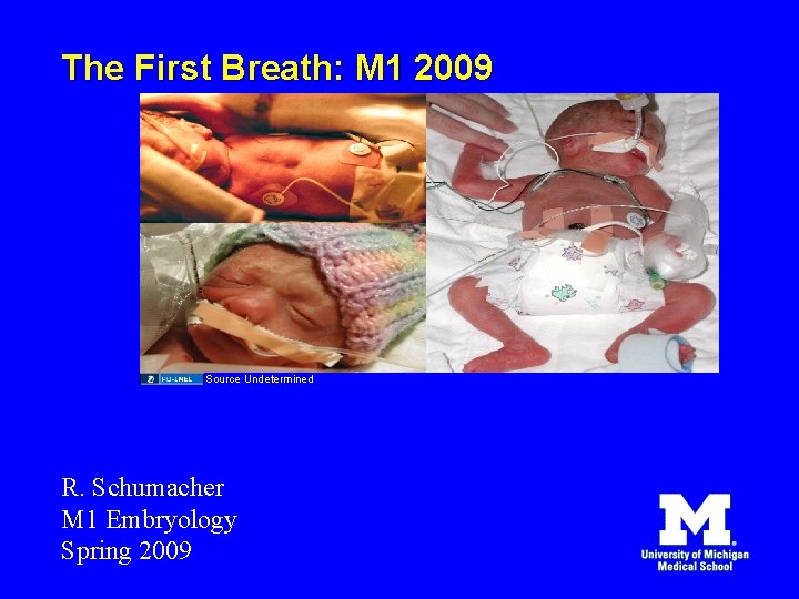 The First Breath: M 1 2009 Source Undetermined R. Schumacher M 1 Embryology Spring