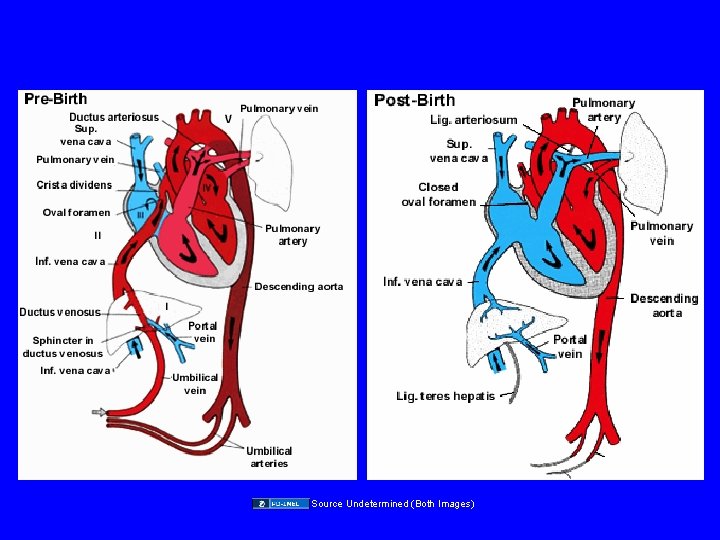 Source Undetermined (Both Images) 