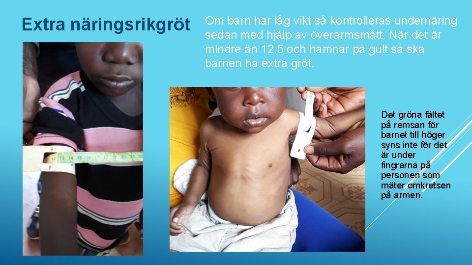 Extra näringsrikgröt Om barn har låg vikt så kontrolleras undernäring sedan med hjälp av