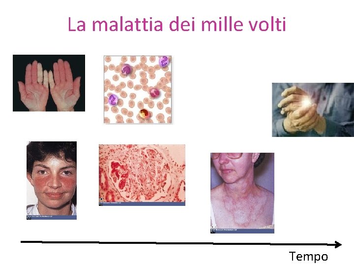 La malattia dei mille volti Tempo 