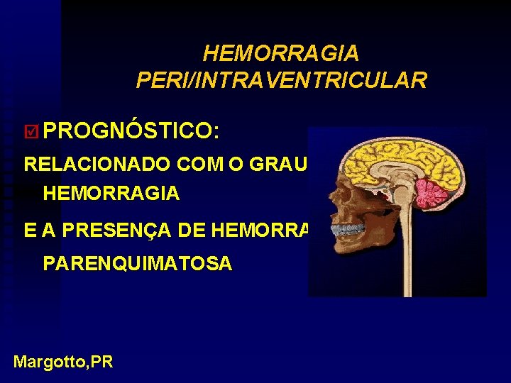 HEMORRAGIA PERI/INTRAVENTRICULAR þ PROGNÓSTICO: RELACIONADO COM O GRAU DA HEMORRAGIA E A PRESENÇA DE