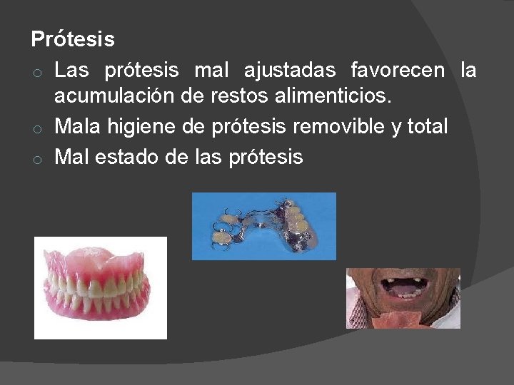 Prótesis o Las prótesis mal ajustadas favorecen la acumulación de restos alimenticios. o Mala