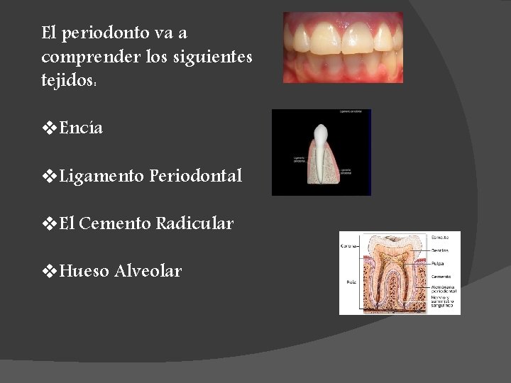 El periodonto va a comprender los siguientes tejidos: v. Encía v. Ligamento Periodontal v.