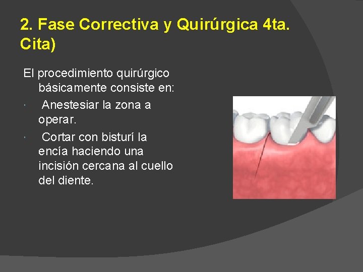 2. Fase Correctiva y Quirúrgica 4 ta. Cita) El procedimiento quirúrgico básicamente consiste en: