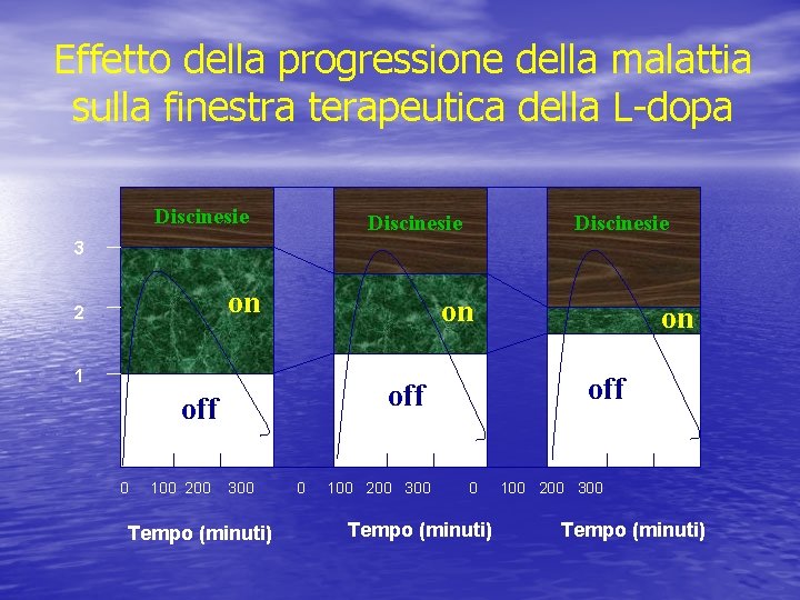 Effetto della progressione della malattia sulla finestra terapeutica della L-dopa Discinesie 3 on 2