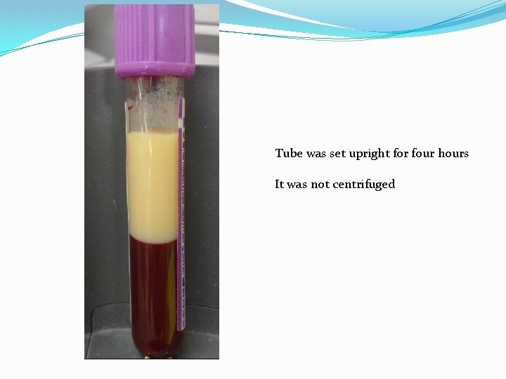 Tube was set upright for four hours It was not centrifuged 