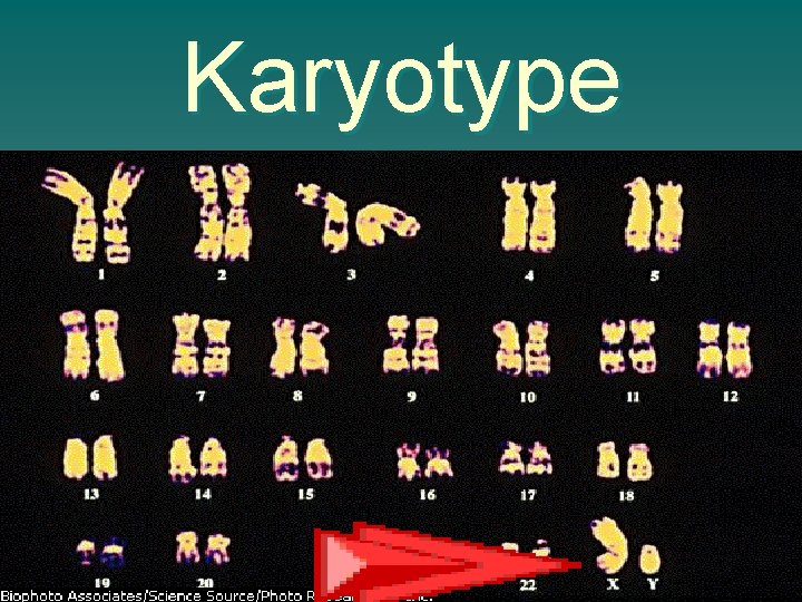 Karyotype Karyotype