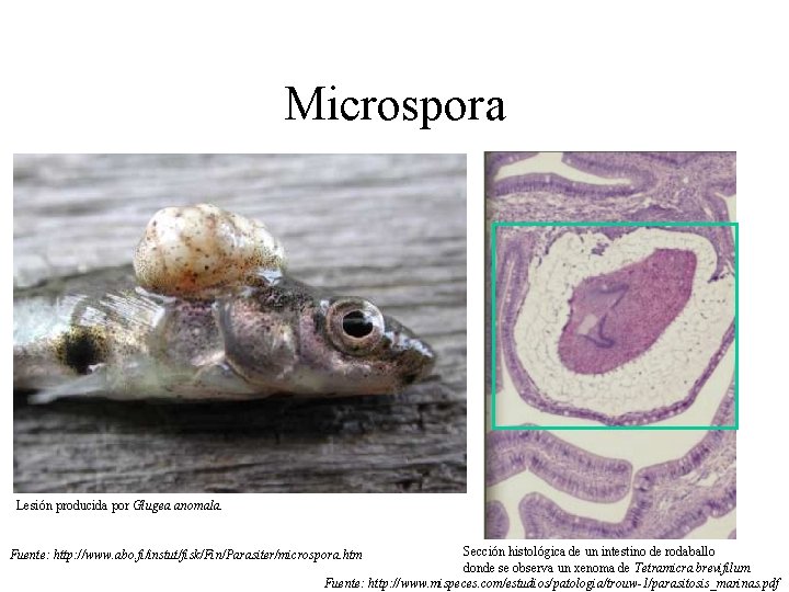 Microspora Lesión producida por Glugea anomala. Sección histológica de un intestino de rodaballo donde Microspora Lesión producida por Glugea anomala. Sección histológica de un intestino de rodaballo donde