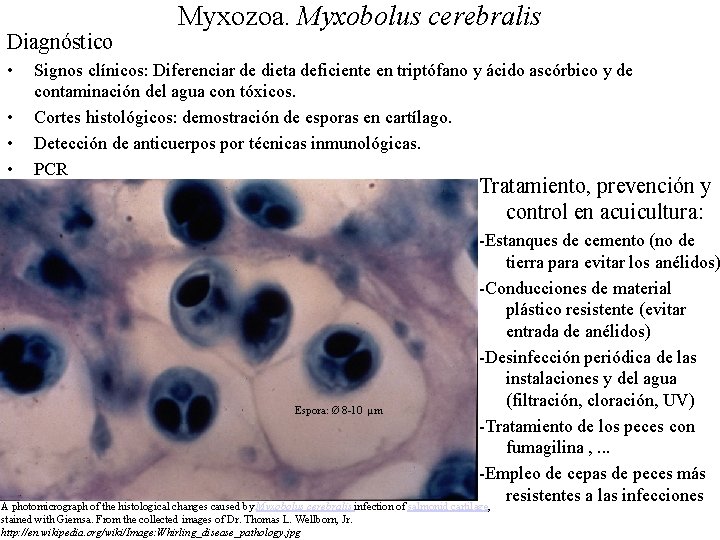 Diagnóstico • • Myxozoa. Myxobolus cerebralis Signos clínicos: Diferenciar de dieta deficiente en triptófano Diagnóstico • • Myxozoa. Myxobolus cerebralis Signos clínicos: Diferenciar de dieta deficiente en triptófano
