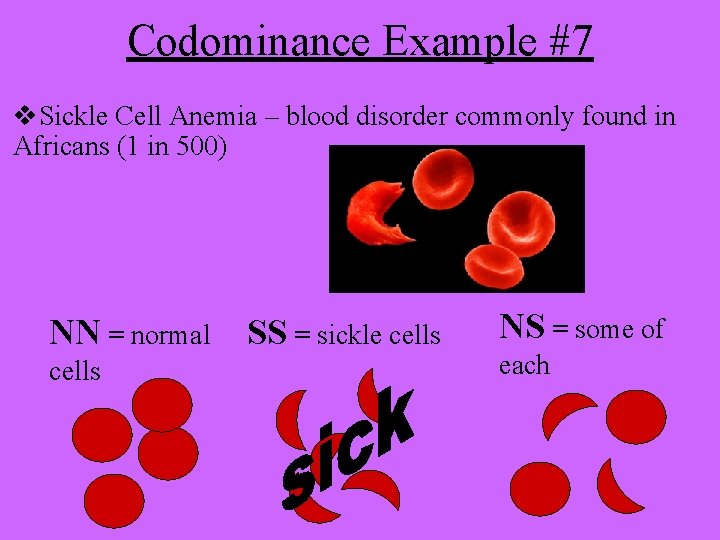 Codominance Example #7 v. Sickle Cell Anemia – blood disorder commonly found in Africans