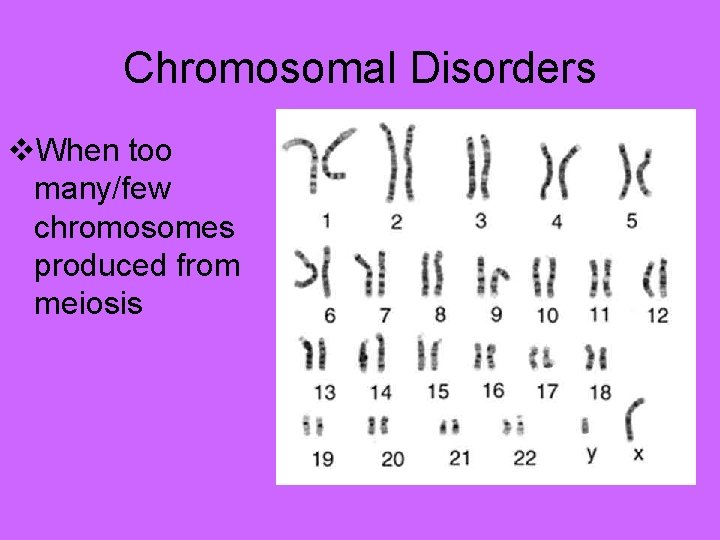 Chromosomal Disorders v. When too many/few chromosomes produced from meiosis 