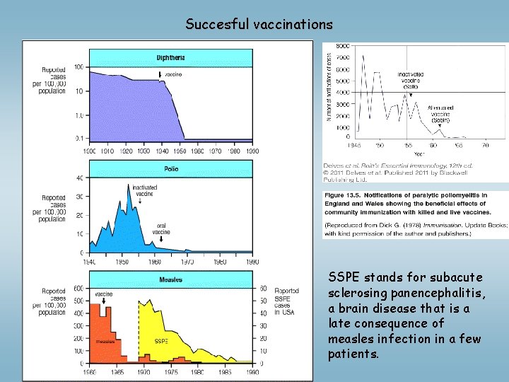 Succesful vaccinations SSPE stands for subacute sclerosing panencephalitis, a brain disease that is a