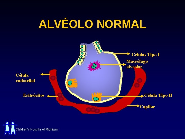 ALVÉOLO NORMAL Células Tipo I Macrófago alveolar Célula endotelial Eritrócitos Célula Tipo II Capilar