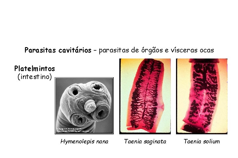 Parasitas cavitários – parasitas de órgãos e vísceras ocas Platelmintos (intestino) Hymenolepis nana Taenia