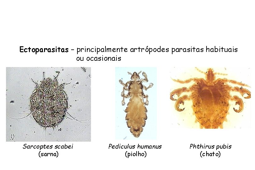 Ectoparasitas – principalmente artrópodes parasitas habituais ou ocasionais Sarcoptes scabei (sarna) Pediculus humanus (piolho)