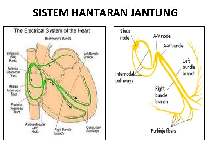 SISTEM HANTARAN JANTUNG 