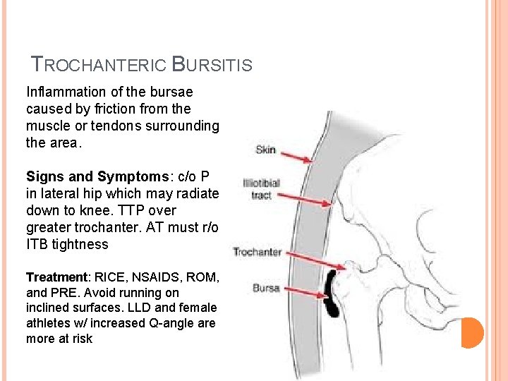 TROCHANTERIC BURSITIS Inflammation of the bursae caused by friction from the muscle or tendons
