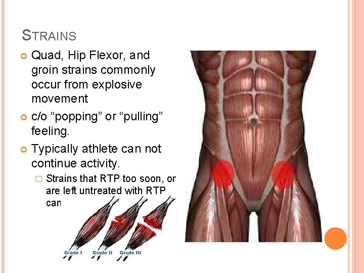 STRAINS Quad, Hip Flexor, and groin strains commonly occur from explosive movement c/o “popping”