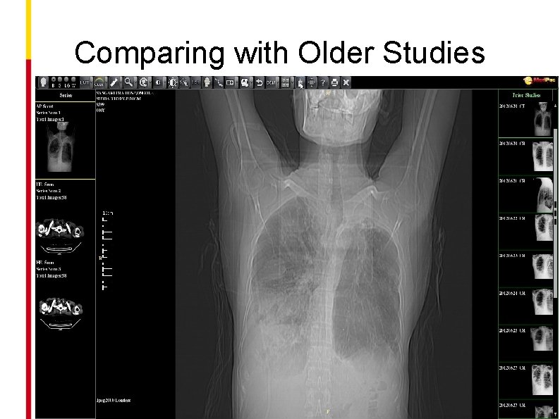 Comparing with Older Studies 