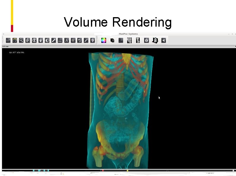 Volume Rendering 