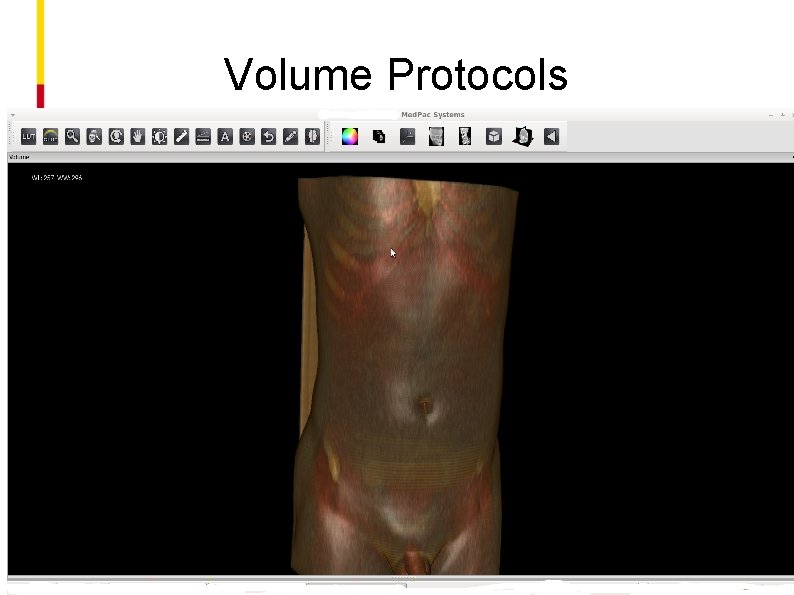 Volume Protocols 
