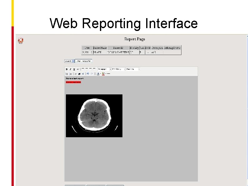 Web Reporting Interface 