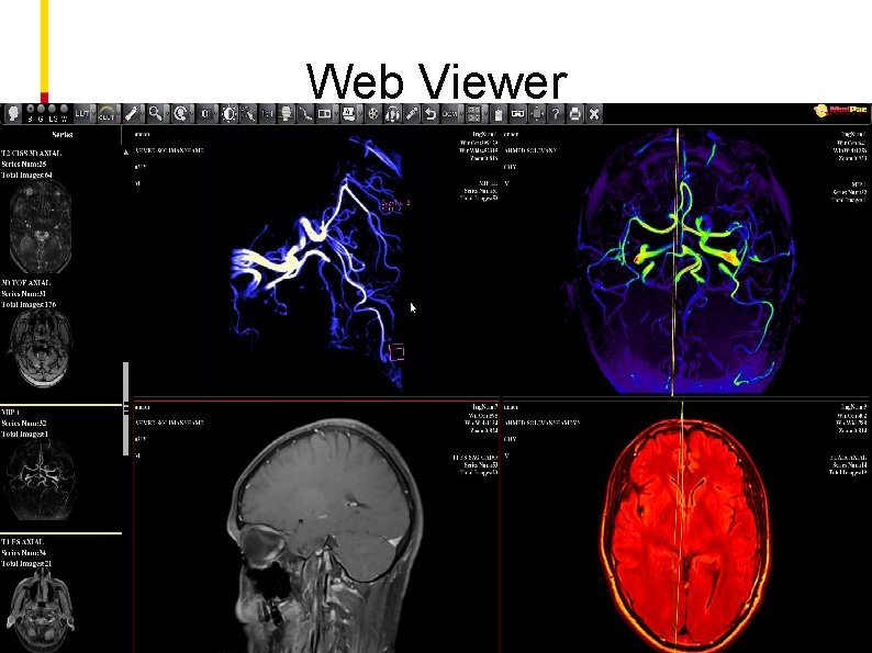 Web Viewer 